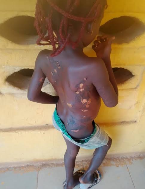 Woman Arrested in Anambra Over Alleged Hot-Knife Assault on Seven-Year-Old Daughter